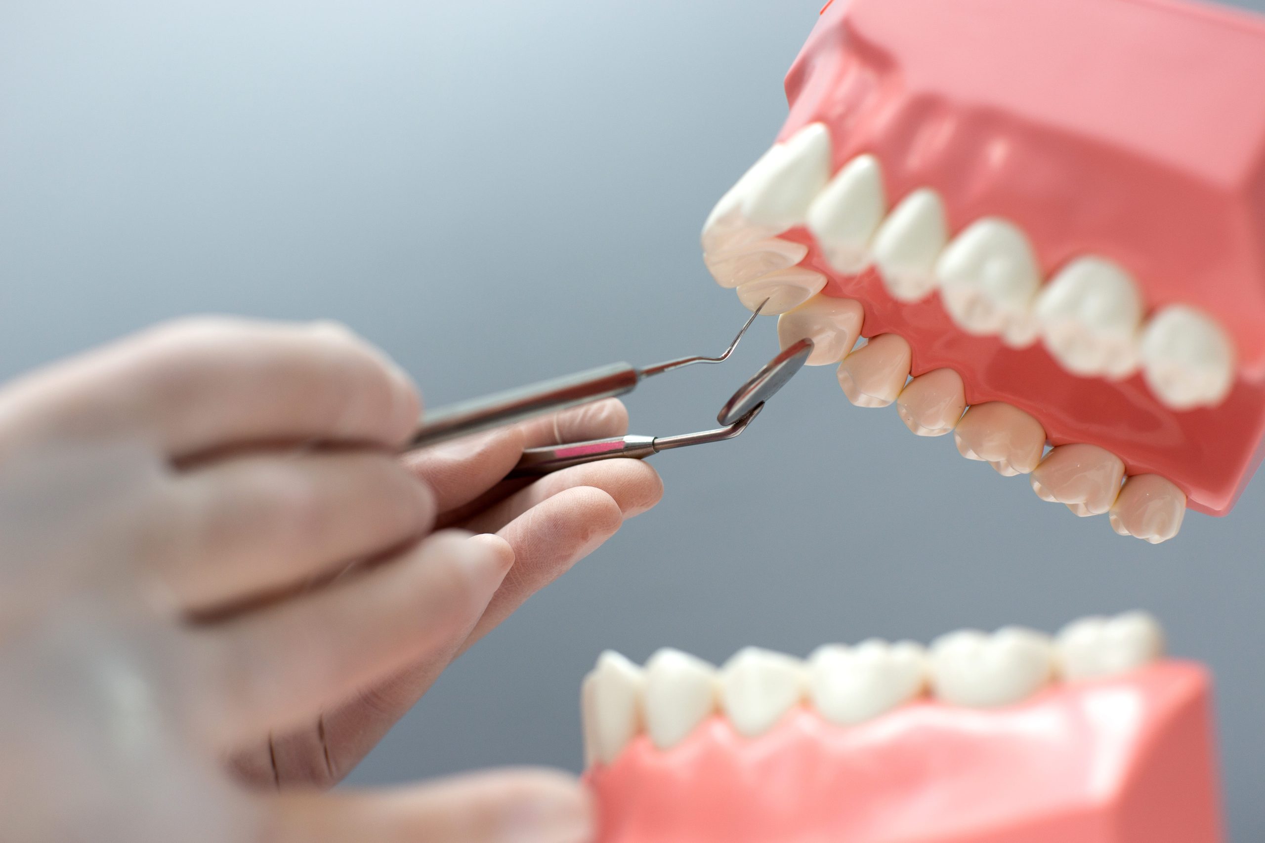 智齒 – 智齒的症狀和治療